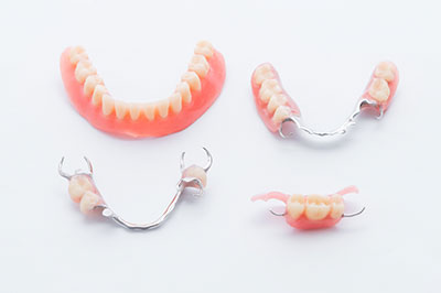 The image shows a collection of dental implants with artificial teeth, displayed on a white background.
